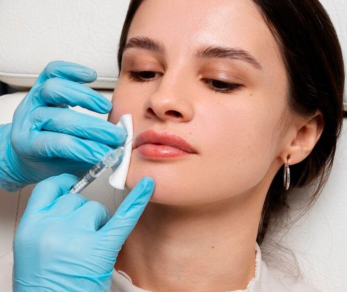 drferreyros_procedimiento-facial-acido-hialuronico