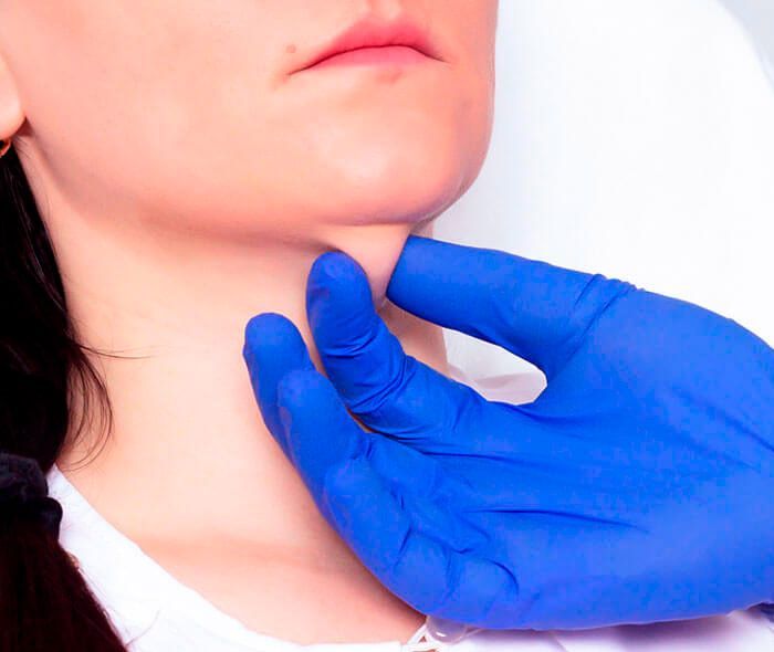 drferreyros_procedimiento-facial-lipopapada-1